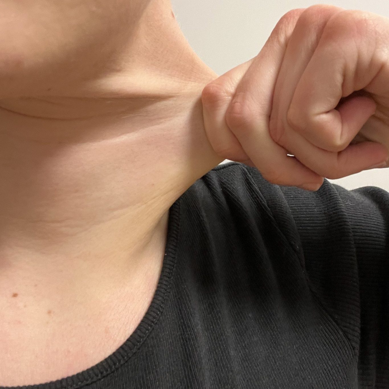 Milde Überdehnbarkeit der Haut Ein Mensch zieht die Haut am Hals mit einer Hand sanft nach außen.